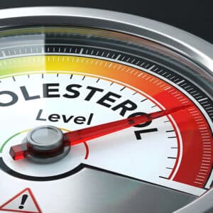 Check-up Lipidico Plus